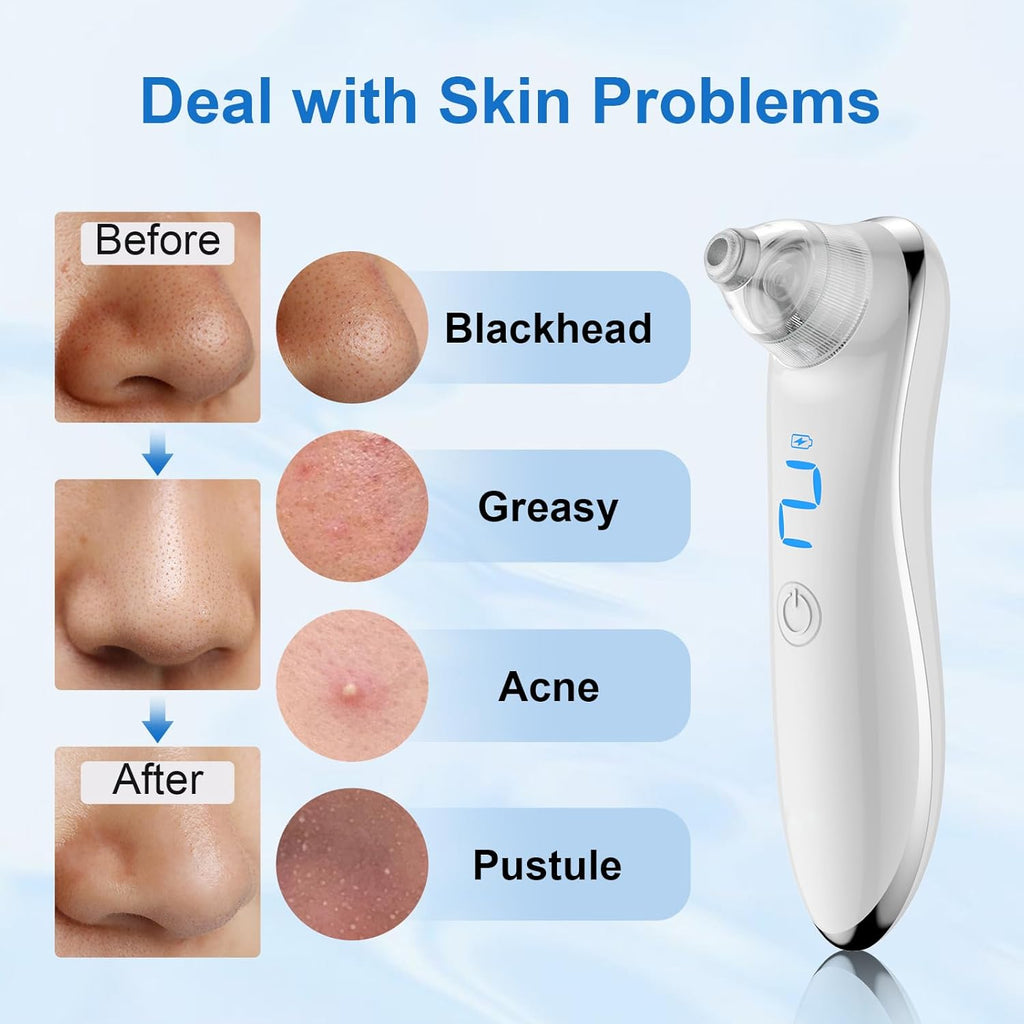 Skinova™ Professional Blackhead Remover & Pore Vacuum Cleaner for Clear, Smooth Skin